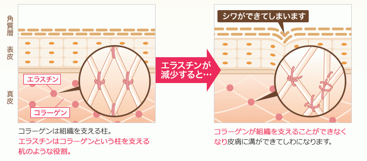 エラスチン