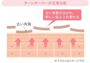 角質